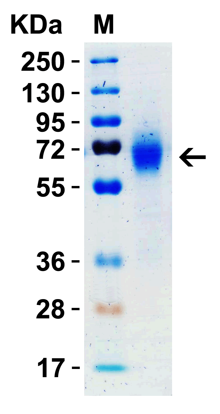 SARS-CoV-2 (COVID-19) Spike RBD + SD1 +SD2 Recombinant Protein