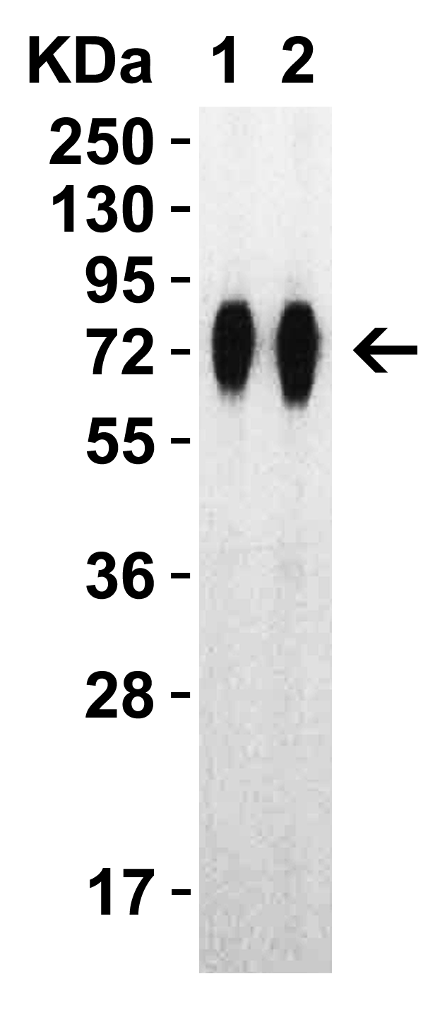 SARS-CoV-2 (COVID-19) Spike RBD + SD1 +SD2 Recombinant Protein