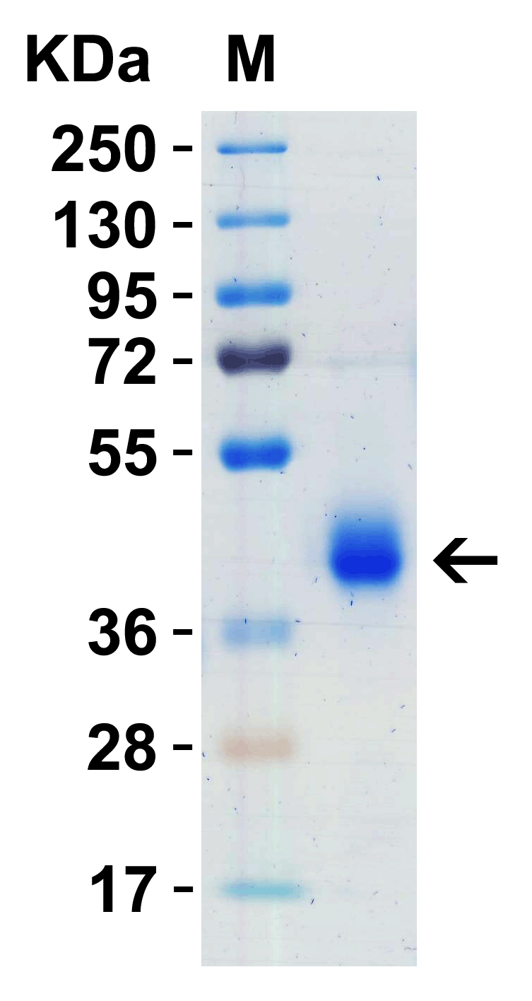 SARS-CoV-2 (COVID-19) Spike RBD + SD1 Recombinant Protein