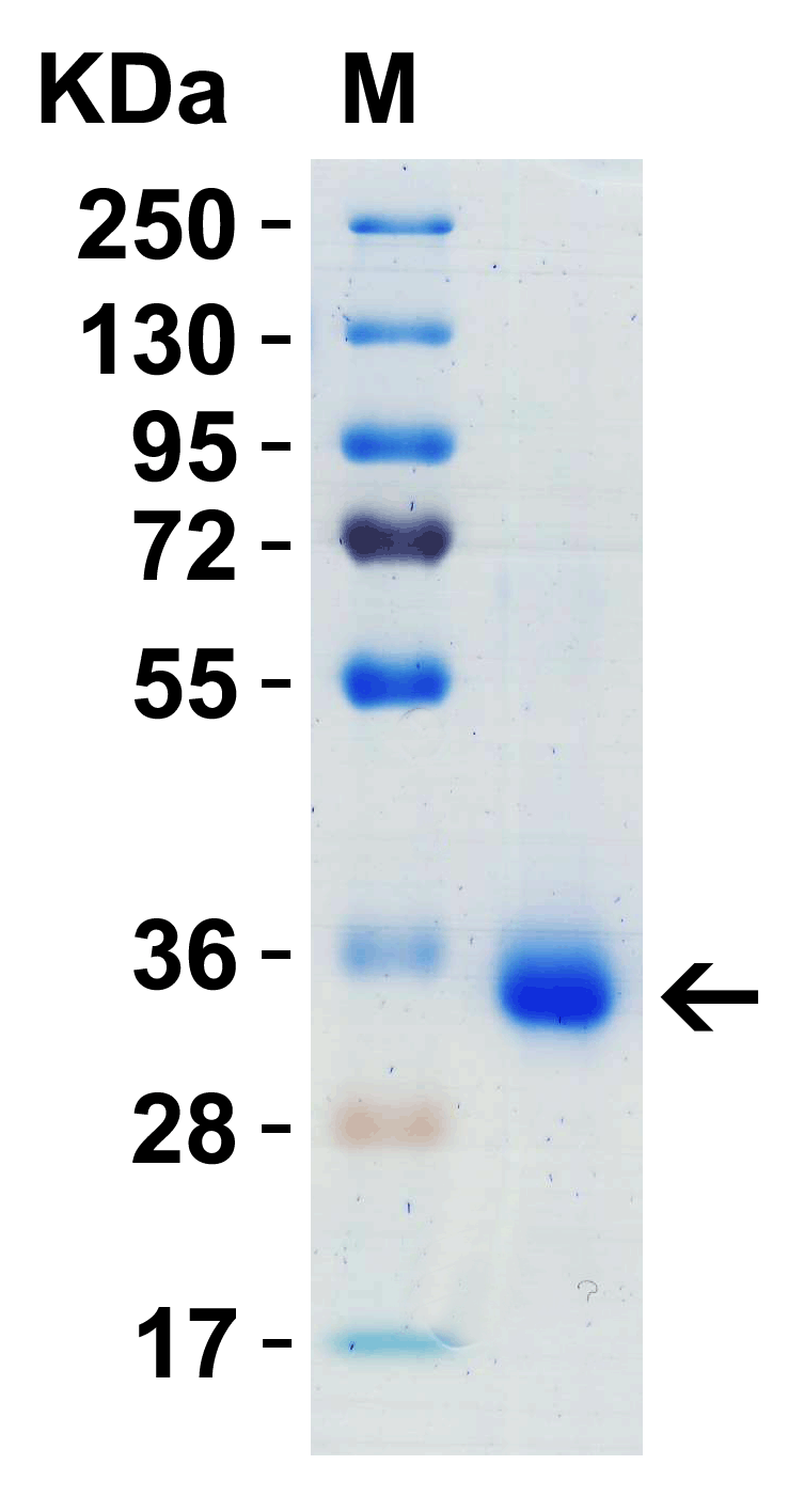 SARS-CoV-2 (COVID-19) Spike RBD Recombinant Protein