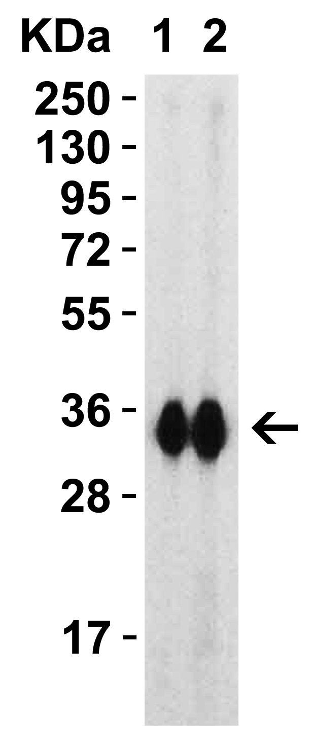 SARS-CoV-2 (COVID-19) Spike RBD Recombinant Protein