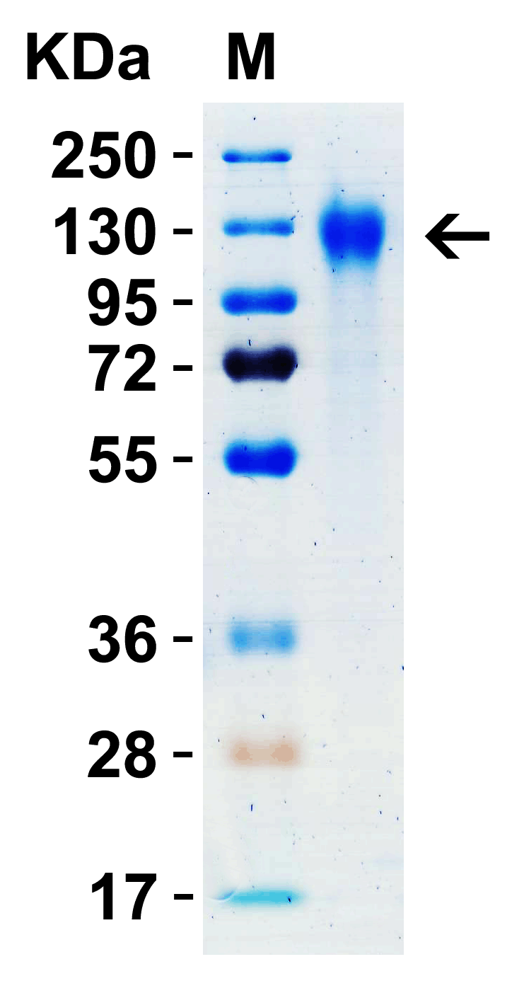 SARS-CoV-2 (COVID-19) Spike S1 Recombinant Protein