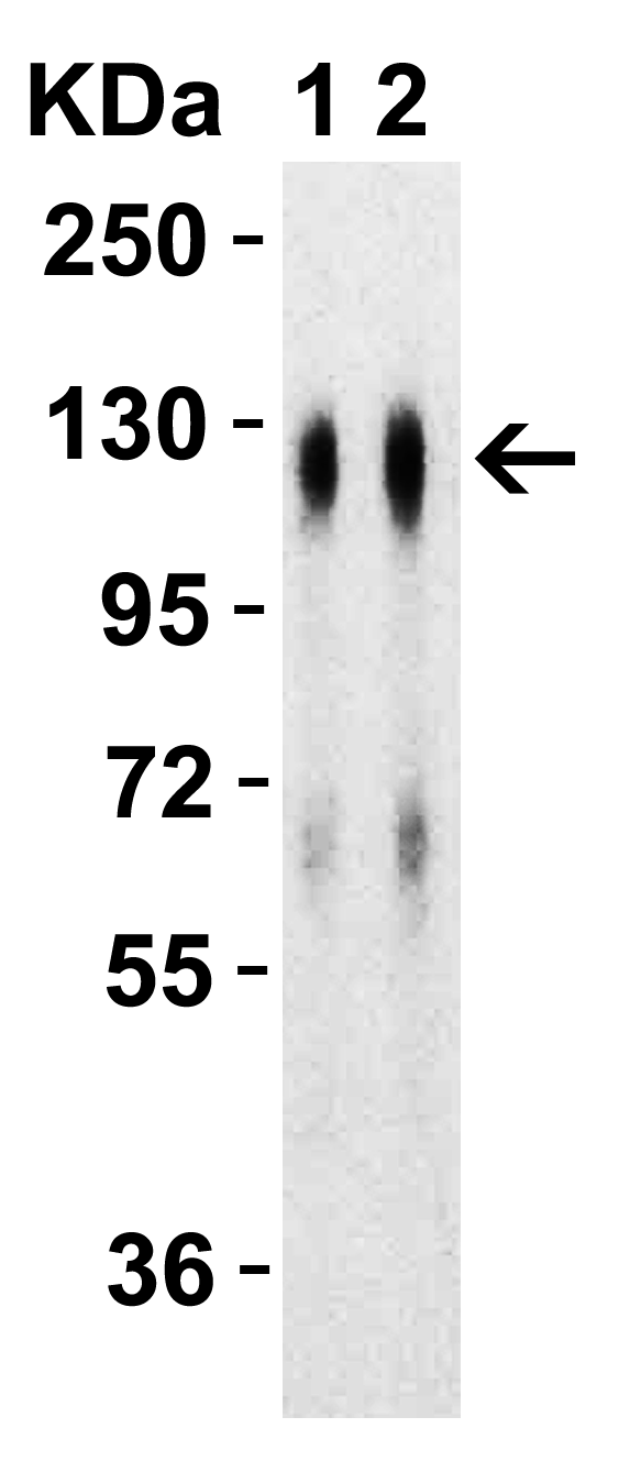 SARS-CoV-2 (COVID-19) Spike S1 Recombinant Protein