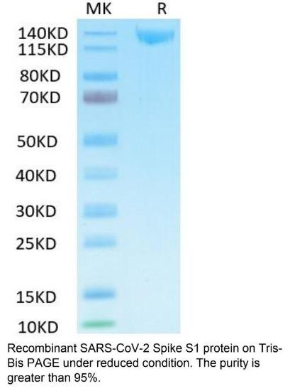 SARS-CoV-2 (COVID-19) Spike S1 Recombinant Protein