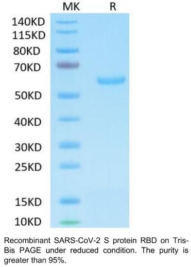 SARS-CoV-2 (COVID-19) Spike RBD Recombinant Protein