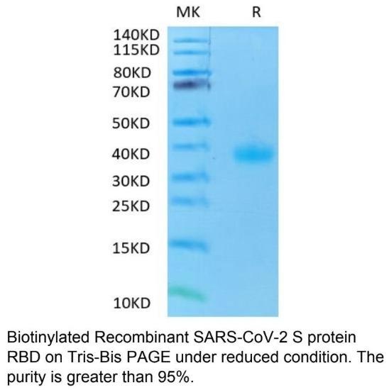 SARS-CoV-2 (COVID-19) Biotinylated Spike RBD Recombinant Protein