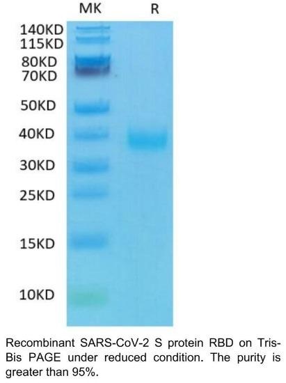 SARS-CoV-2 (COVID-19) Spike RBD Recombinant Protein