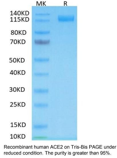 Human ACE2 Recombinant Protein