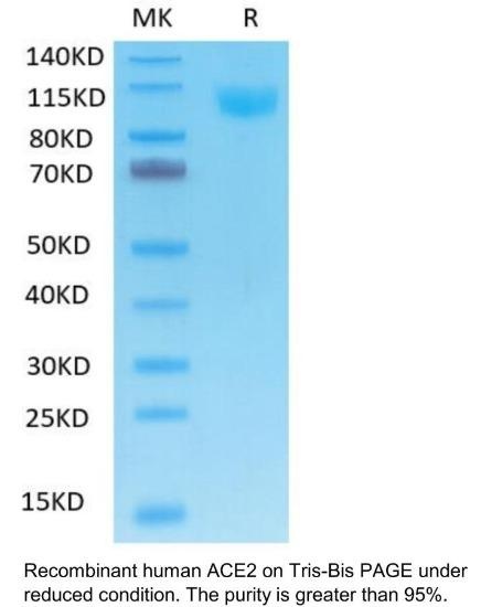 Human ACE2 Recombinant Protein