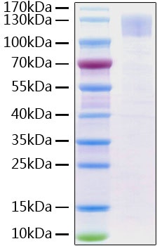 SARS-CoV-2 (COVID-19) Spike S1 Recombinant Protein