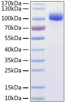 Human ACE2 Recombinant Protein