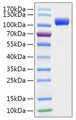 SARS-CoV-2 (COVID-19) Spike S1 Recombinant Protein