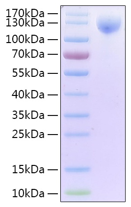 SARS-CoV-2 (COVID-19) Spike S1 Recombinant Protein