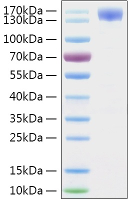 SARS-CoV-2 (COVID-19) Spike S1 Recombinant Protein