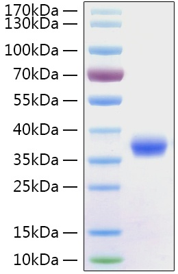 SARS-CoV-2 (COVID-19) Spike RBD Recombinant Protein