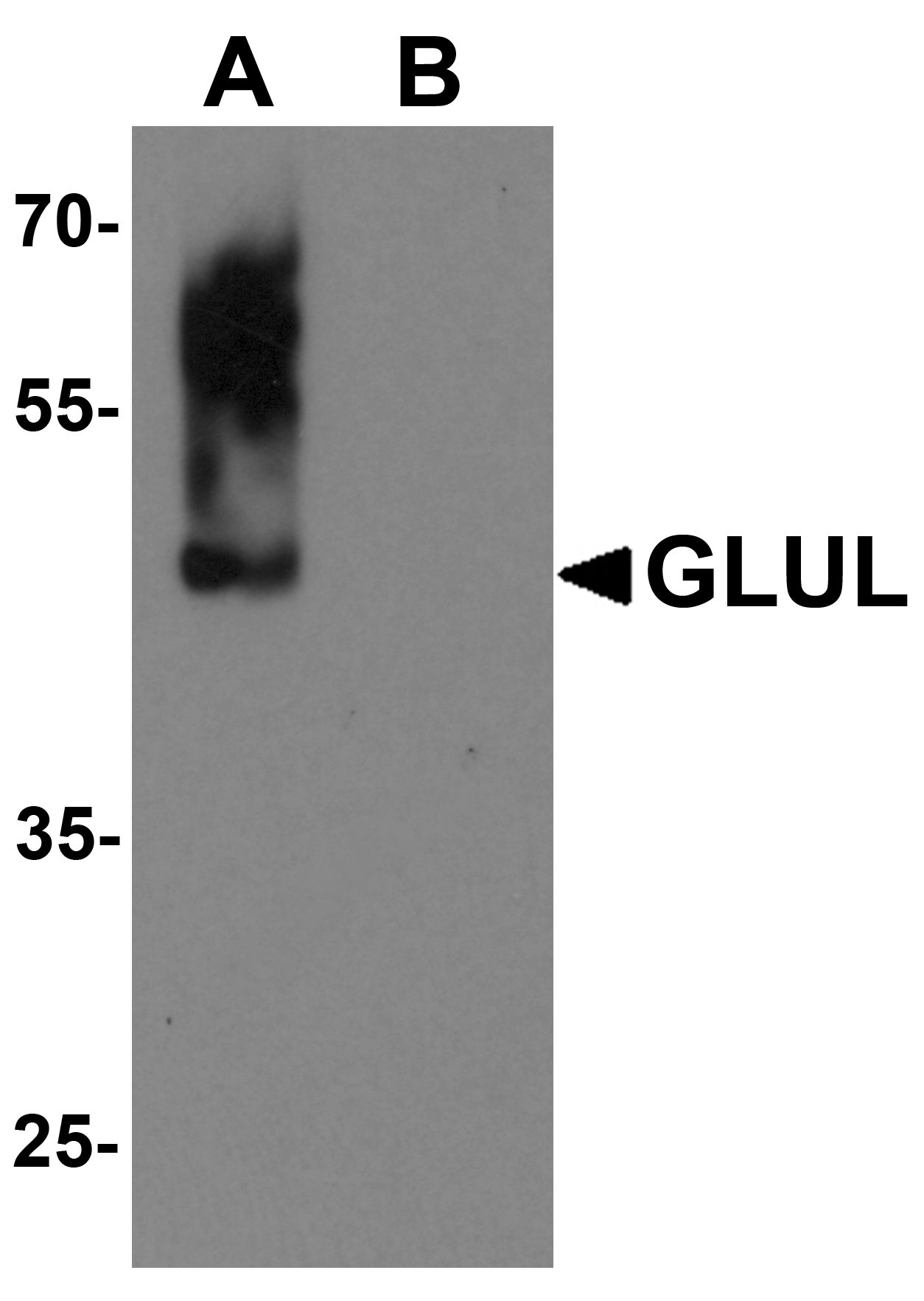 GLUL Peptide