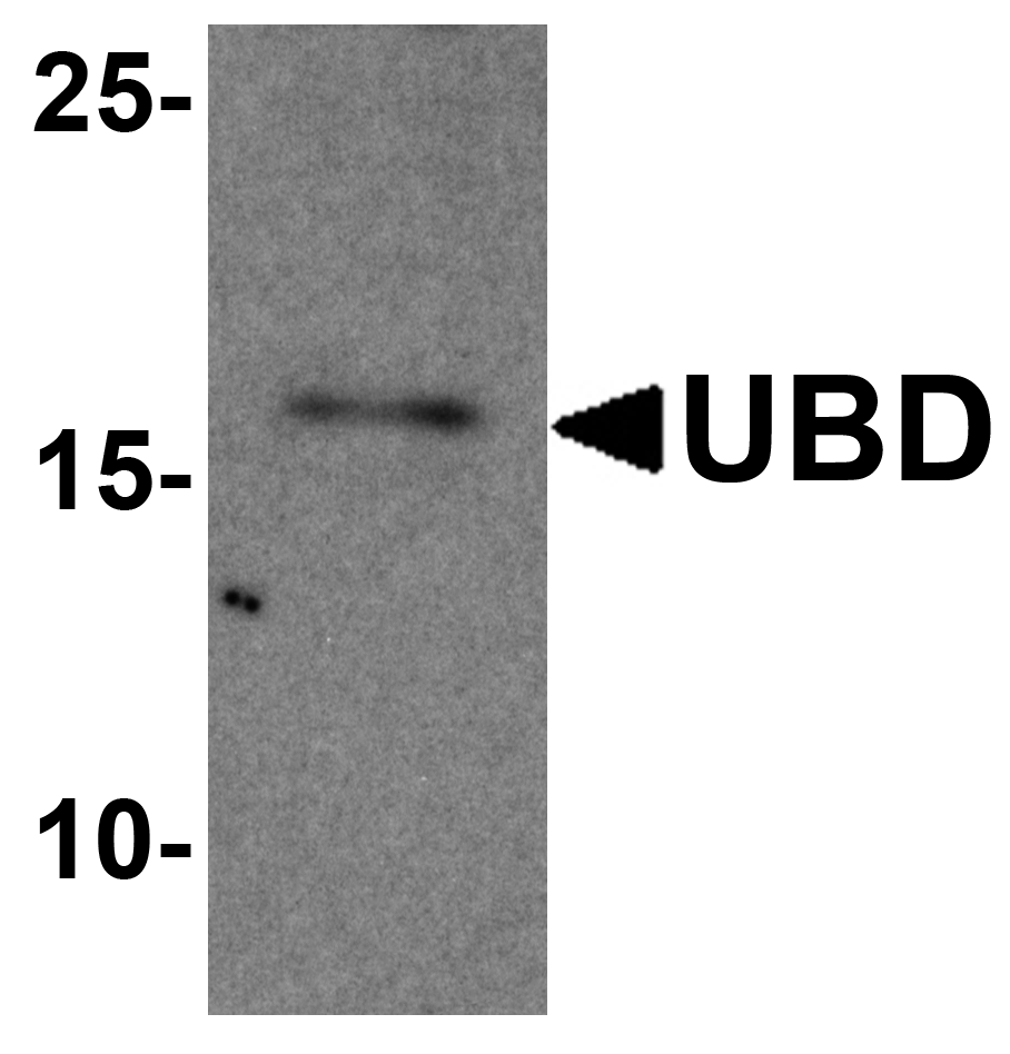 UBD Peptide