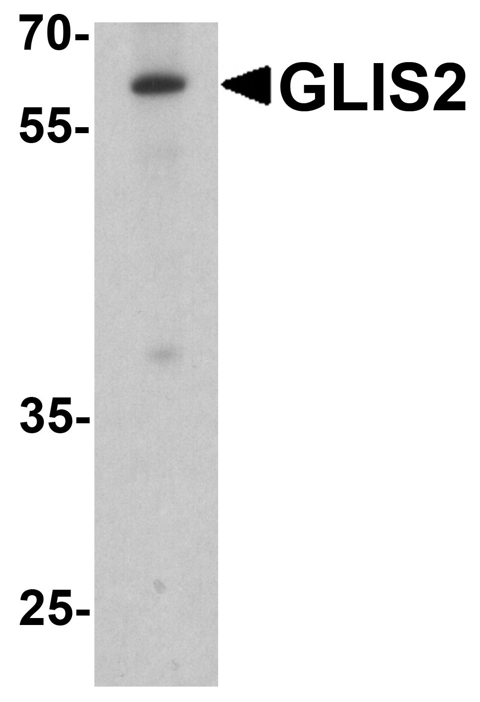 GLIS2 Peptide