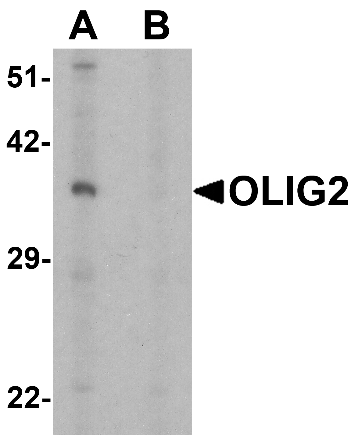 OLIG2 Peptide