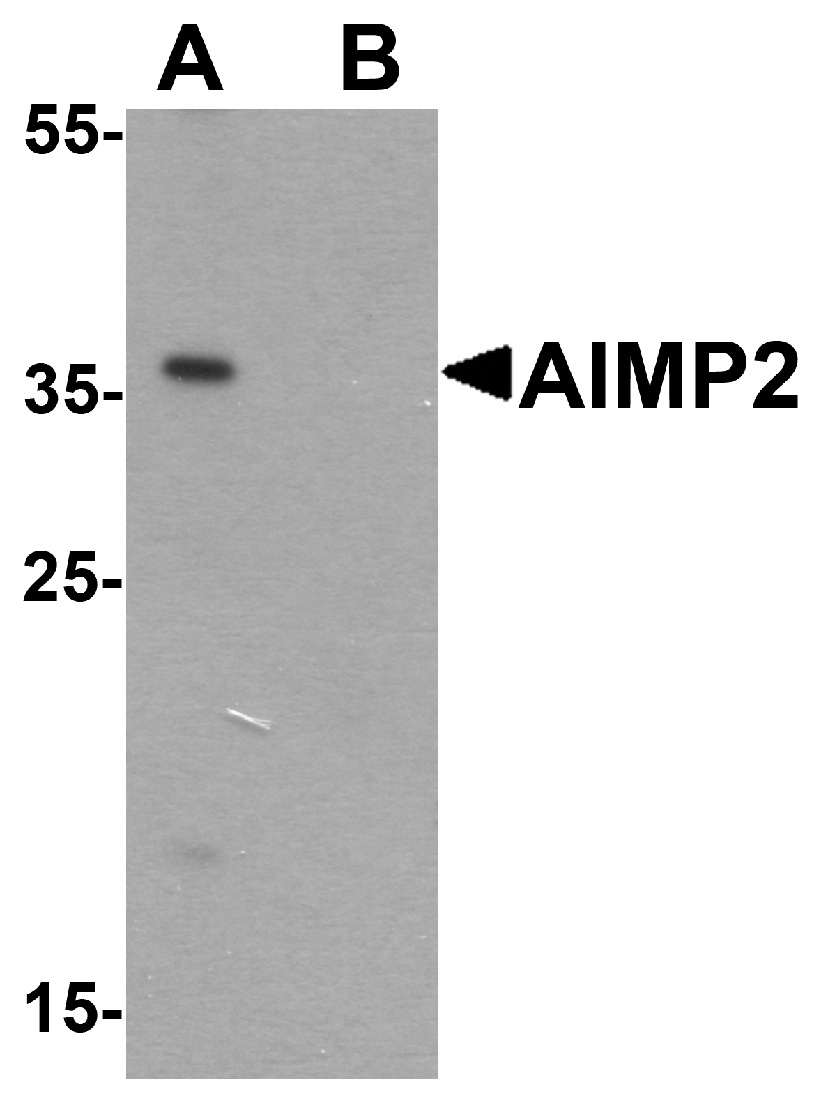 AIMP2 Peptide