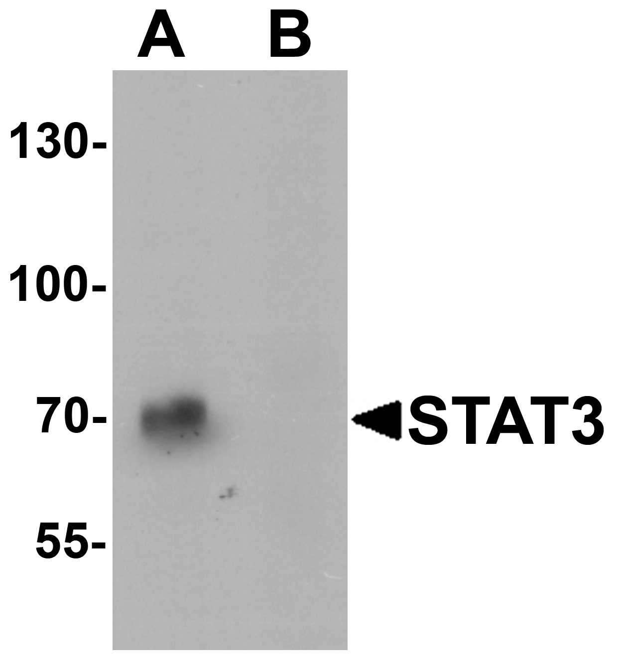 STAT3 Peptide