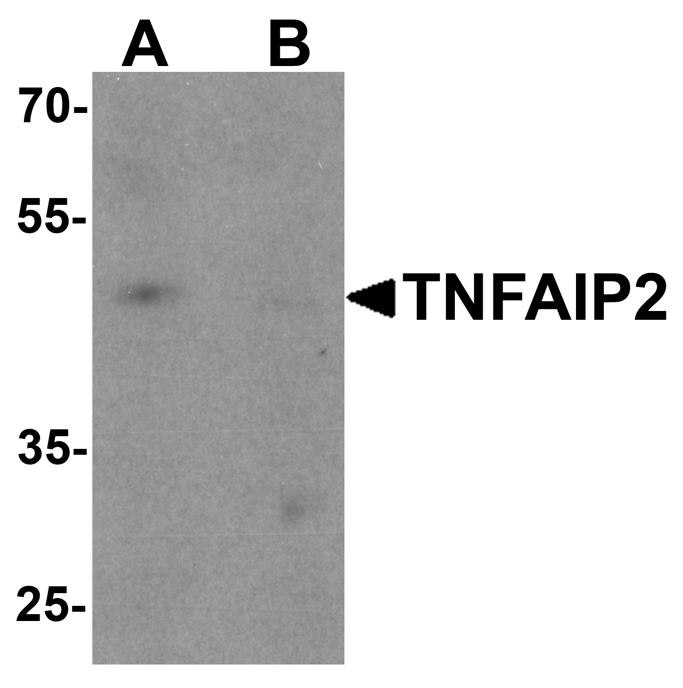 TNFAIP2 Peptide