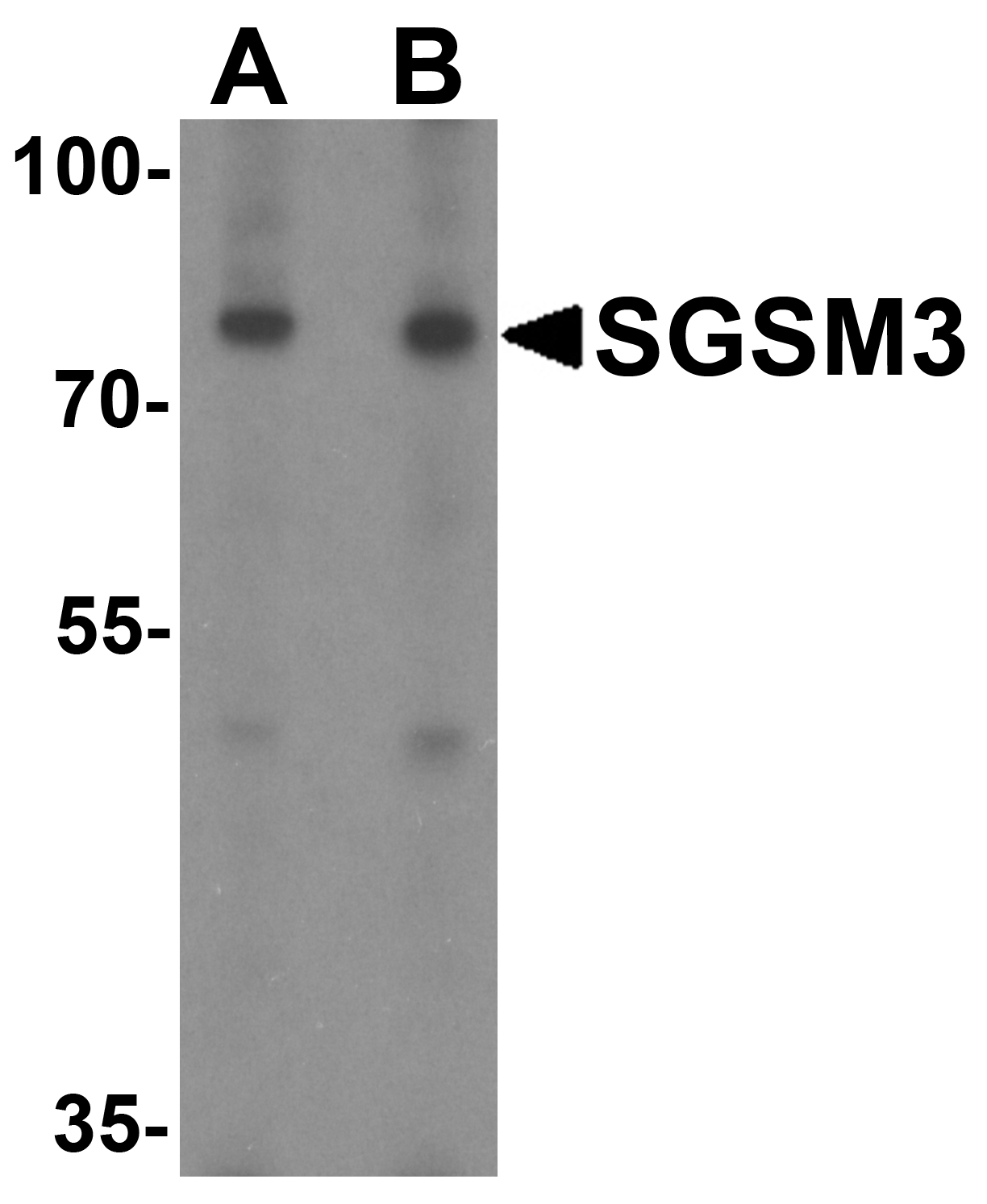 SGSM3 Peptide