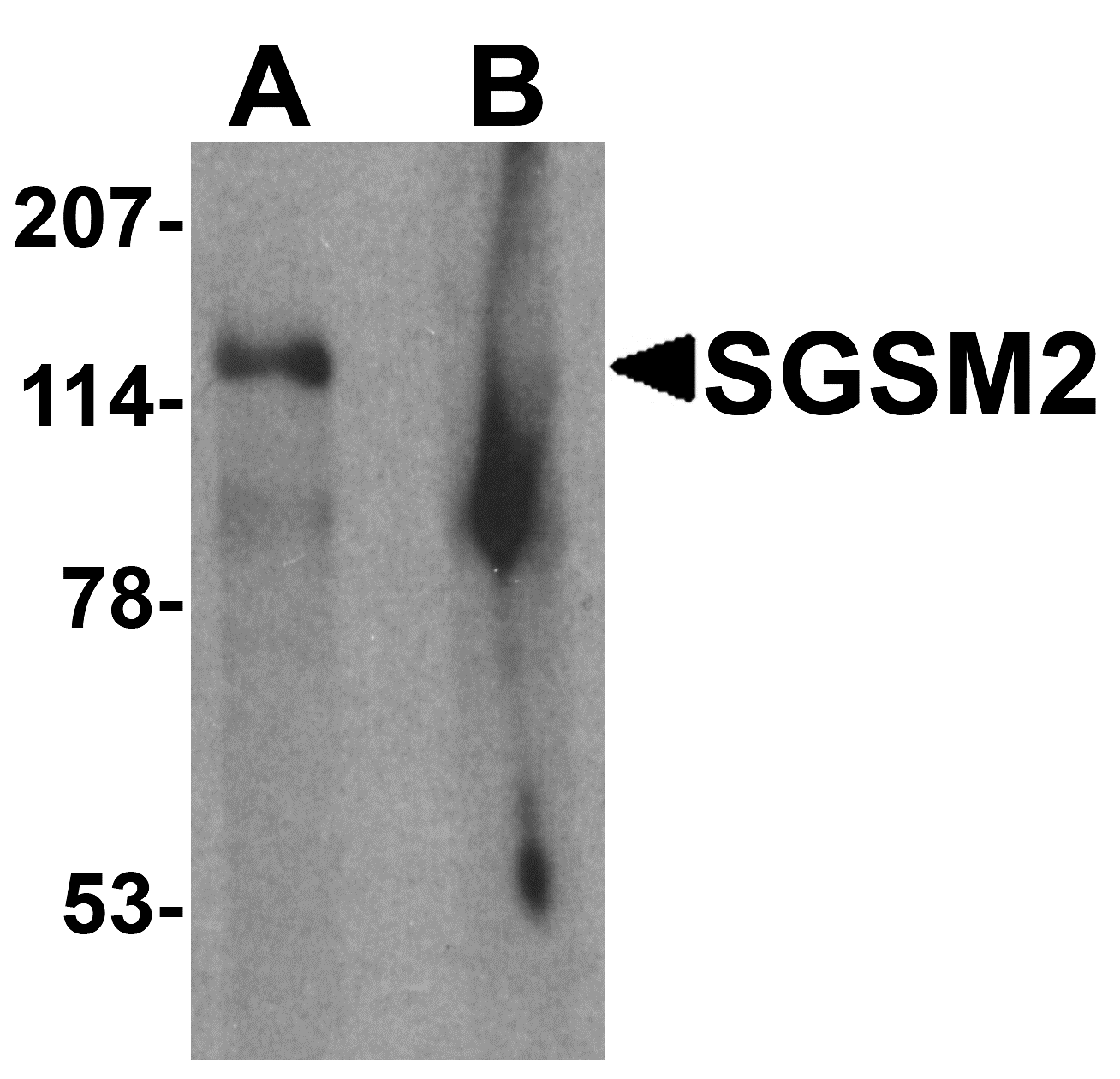 SGSM2 Peptide