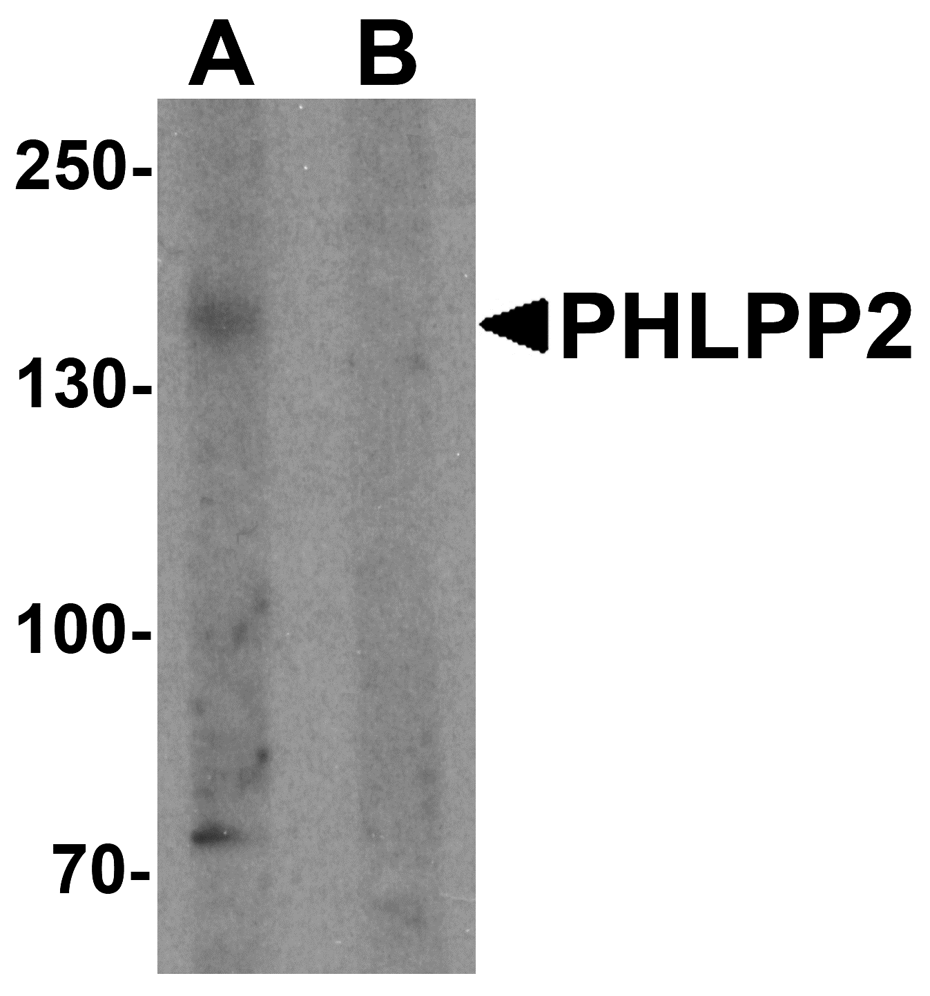 PHLPP2 Peptide