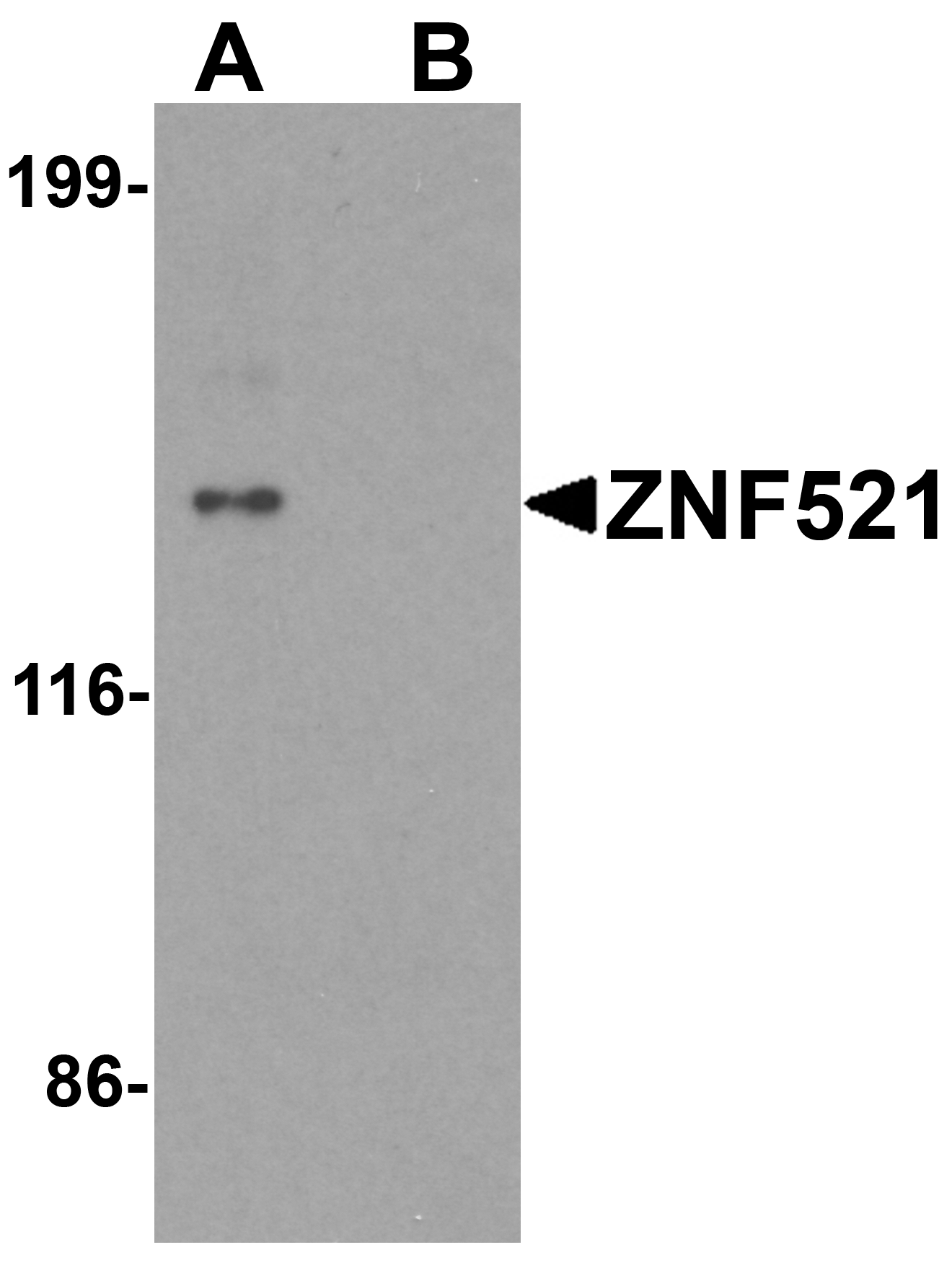 ZNF521 Peptide