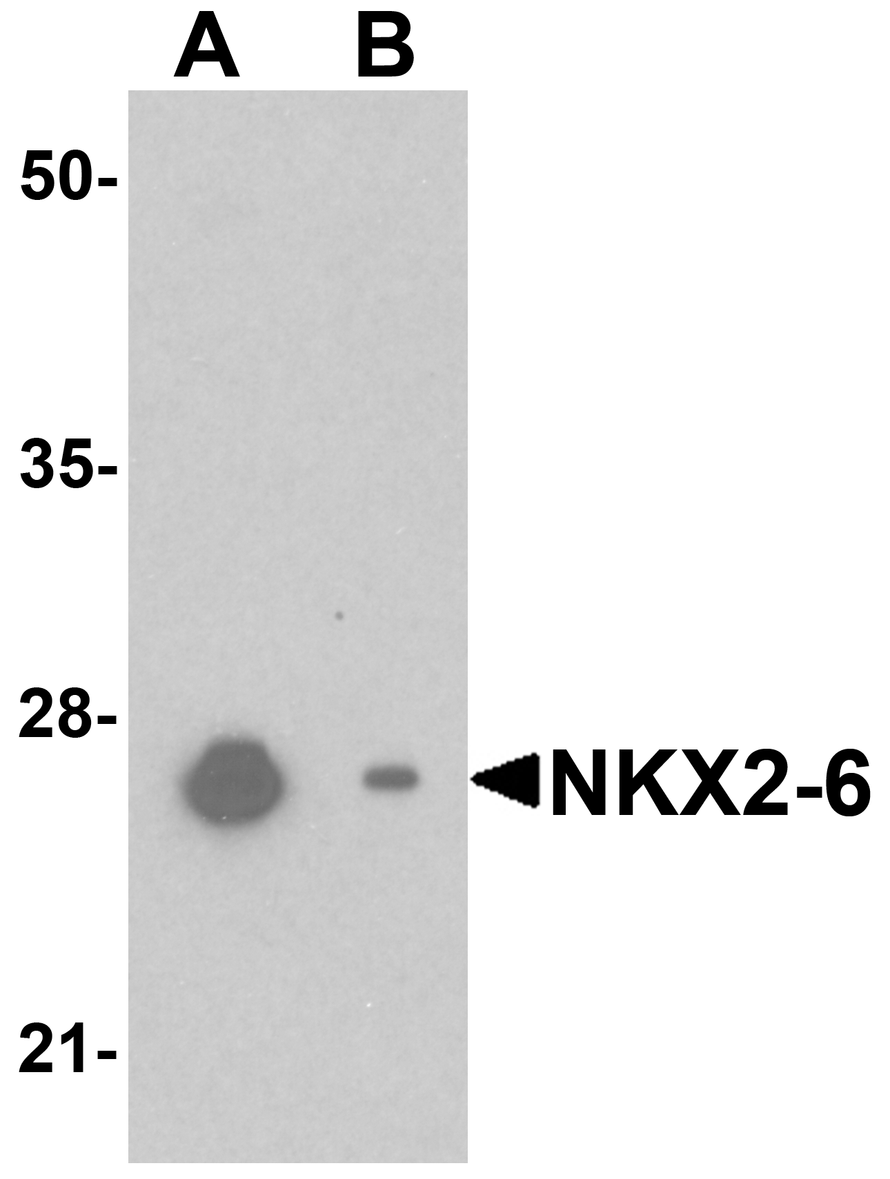 NKX2-6 Peptide