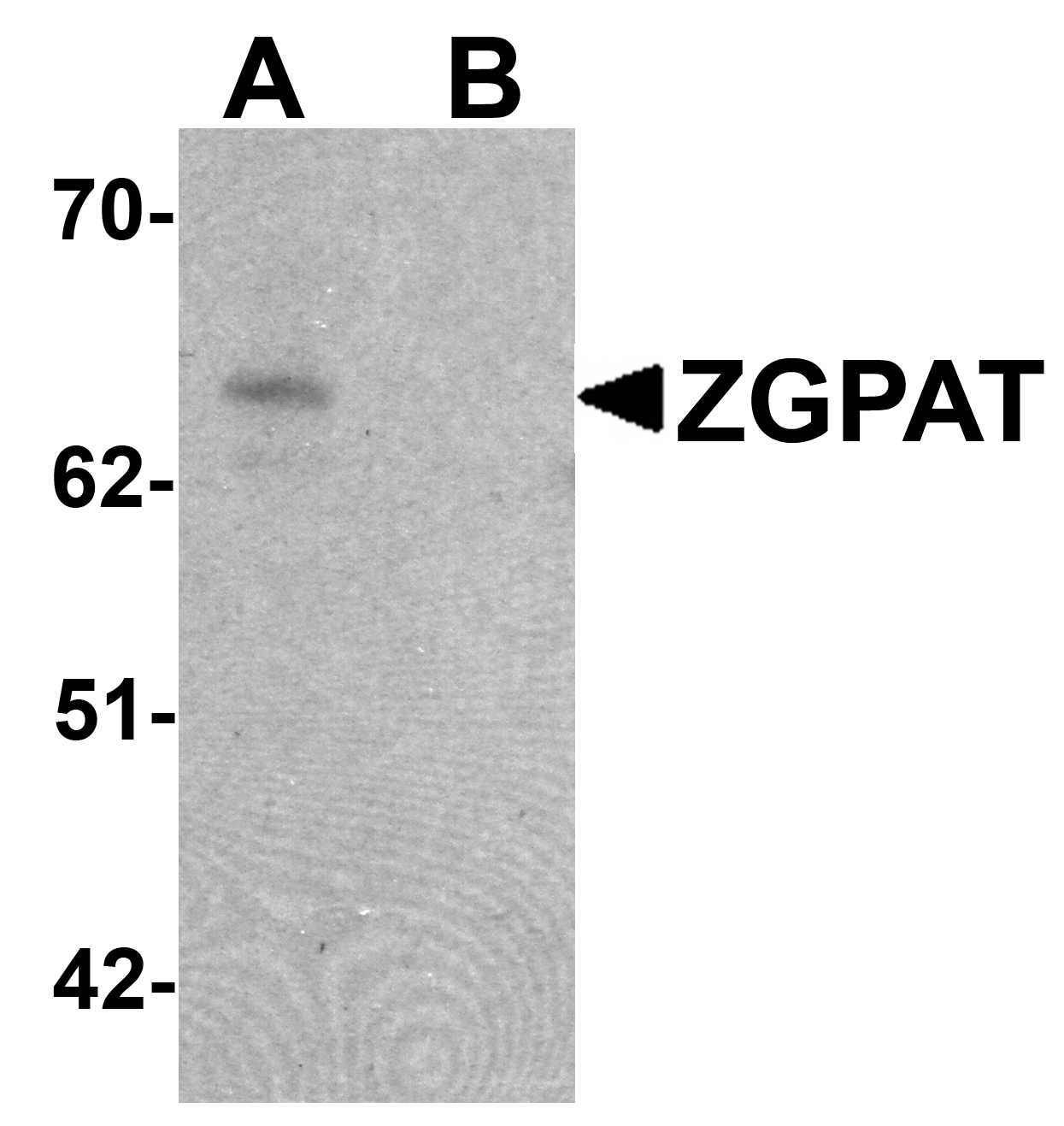 ZGPAT Peptide