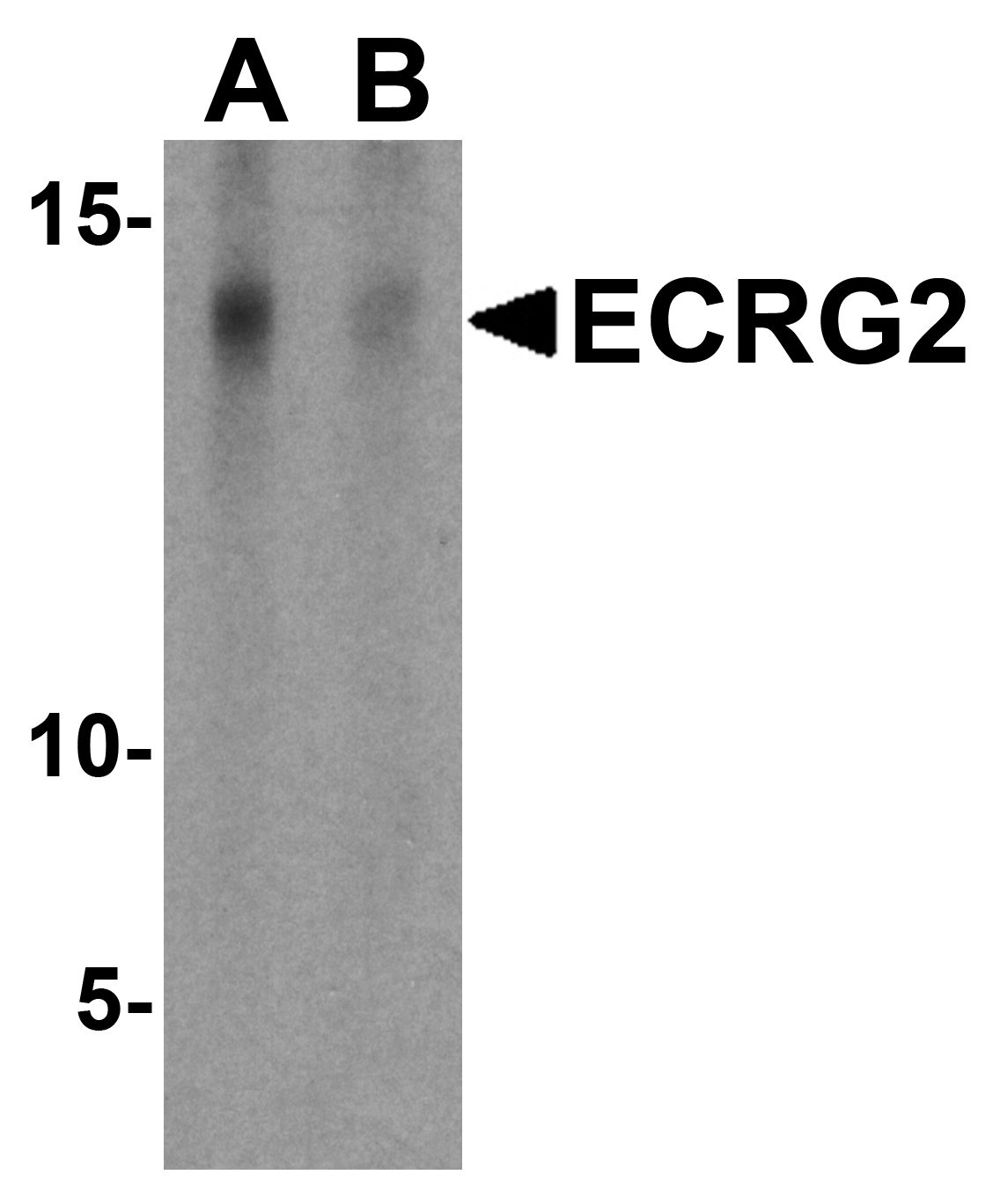 ECRG2 Peptide