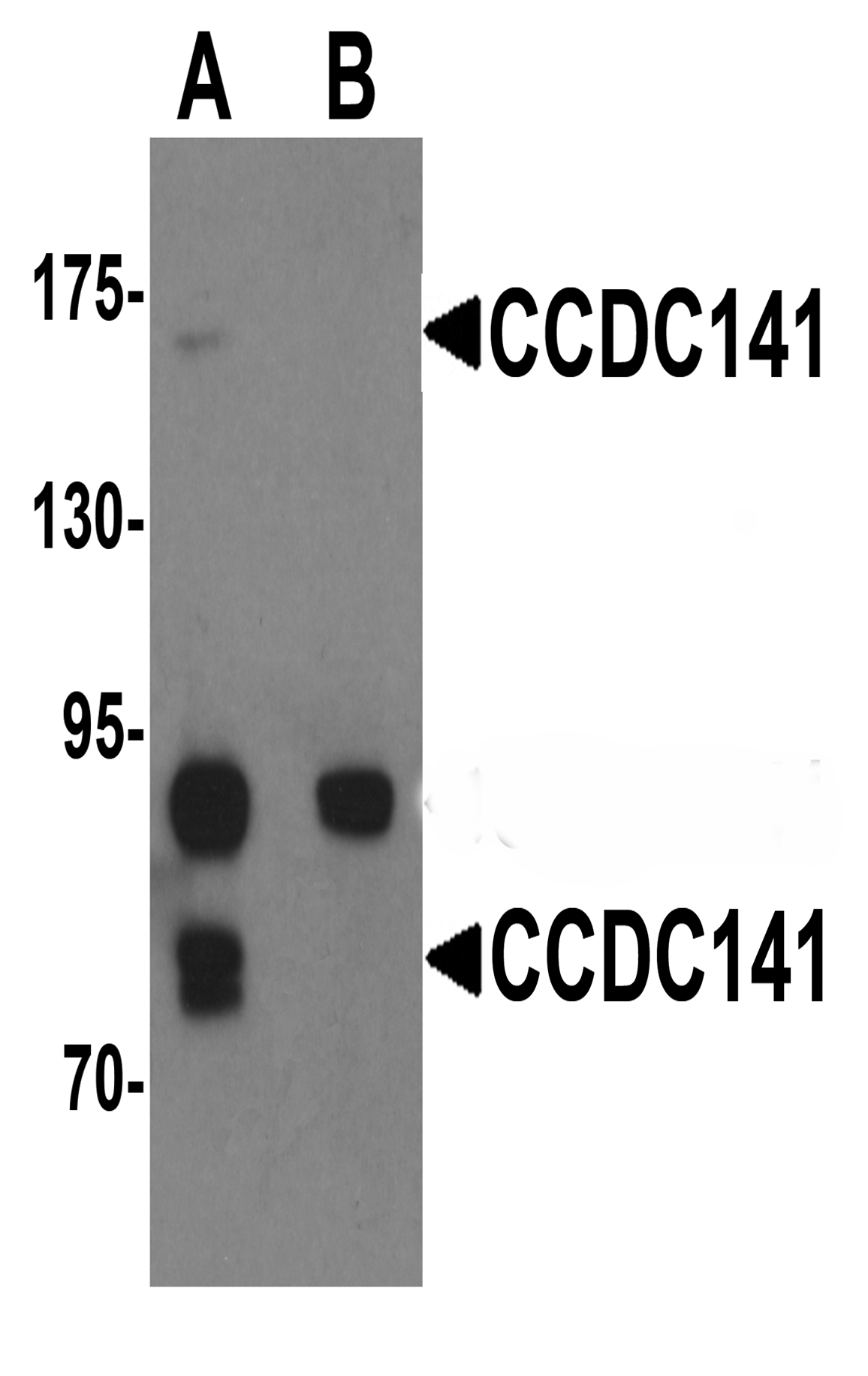 CCDC141 Peptide