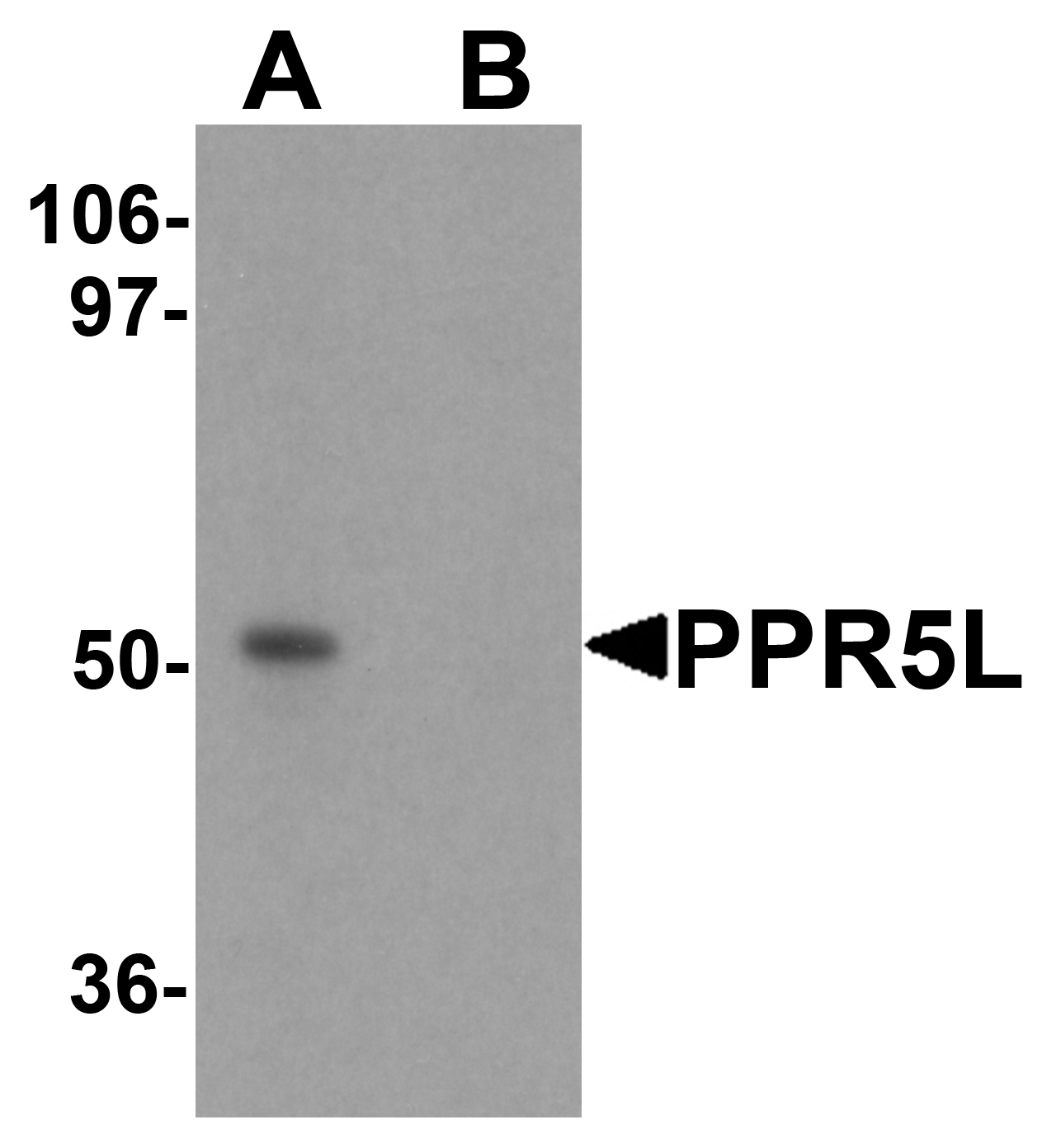PRR5L Peptide