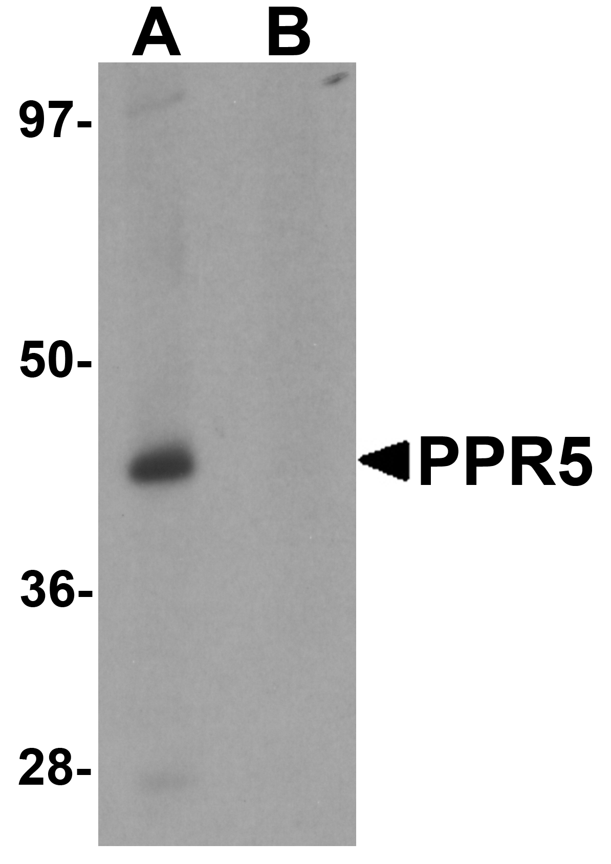 PRR5 Peptide