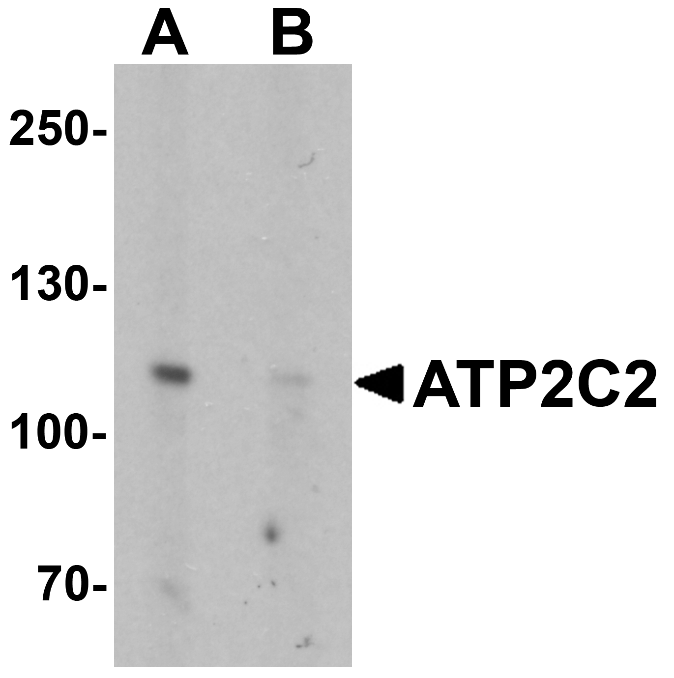 ATP2C2 Peptide