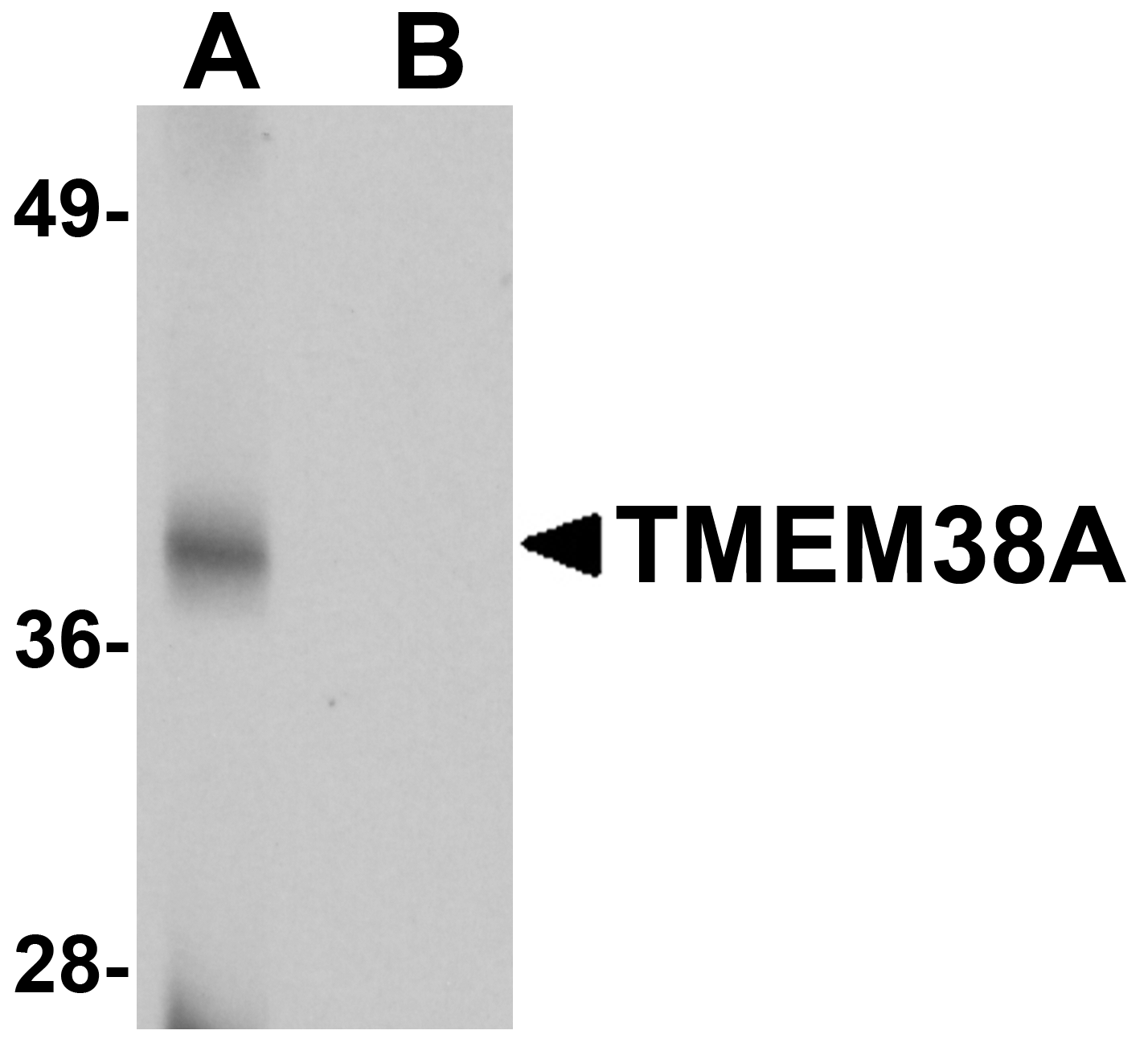 TMEM38A Peptide