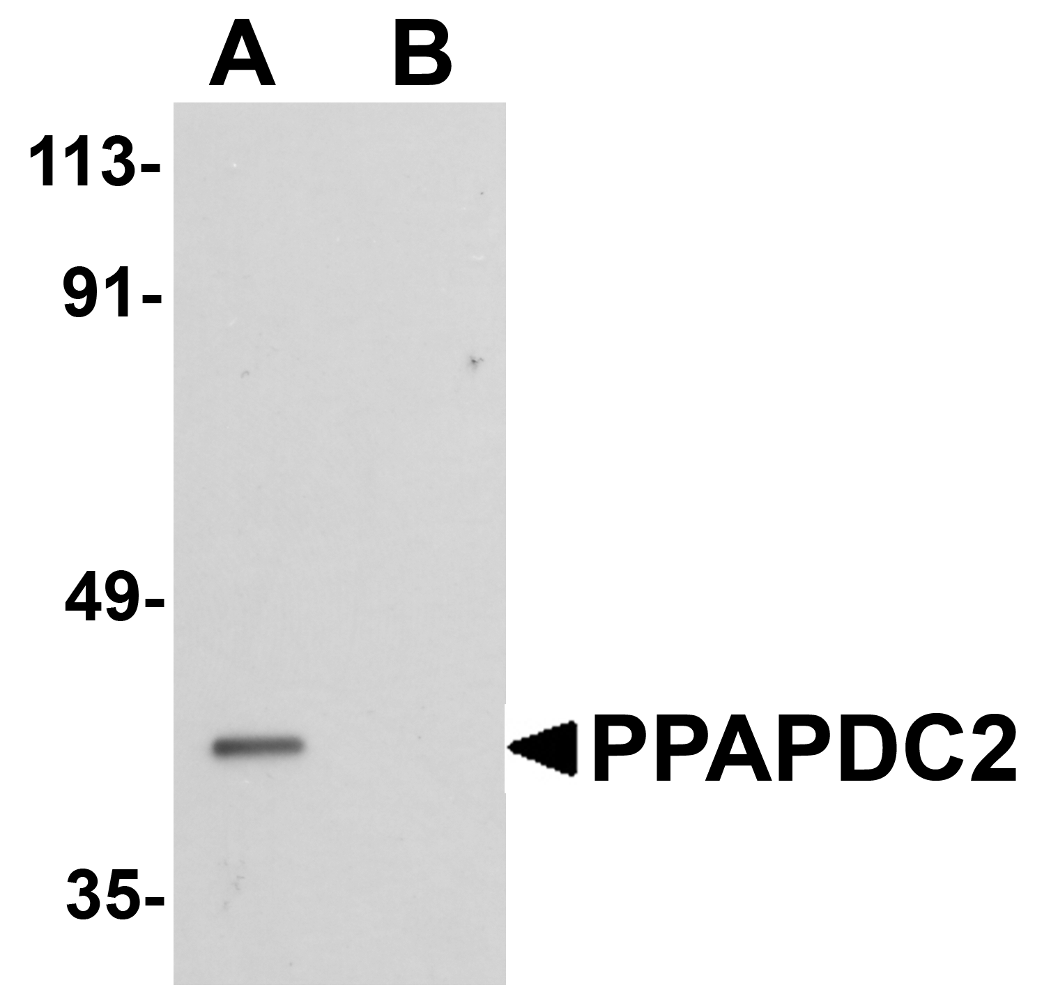 PPAPDC2 Peptide