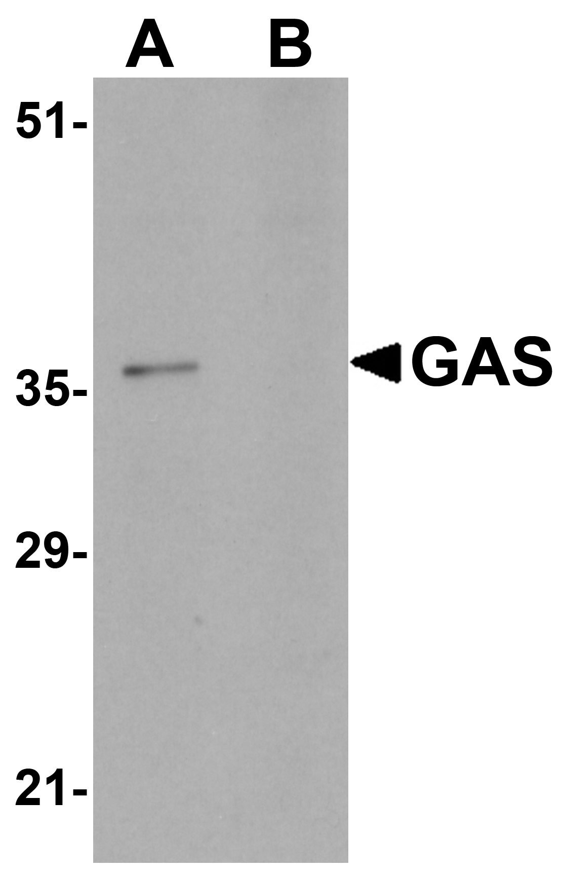 GAS Peptide