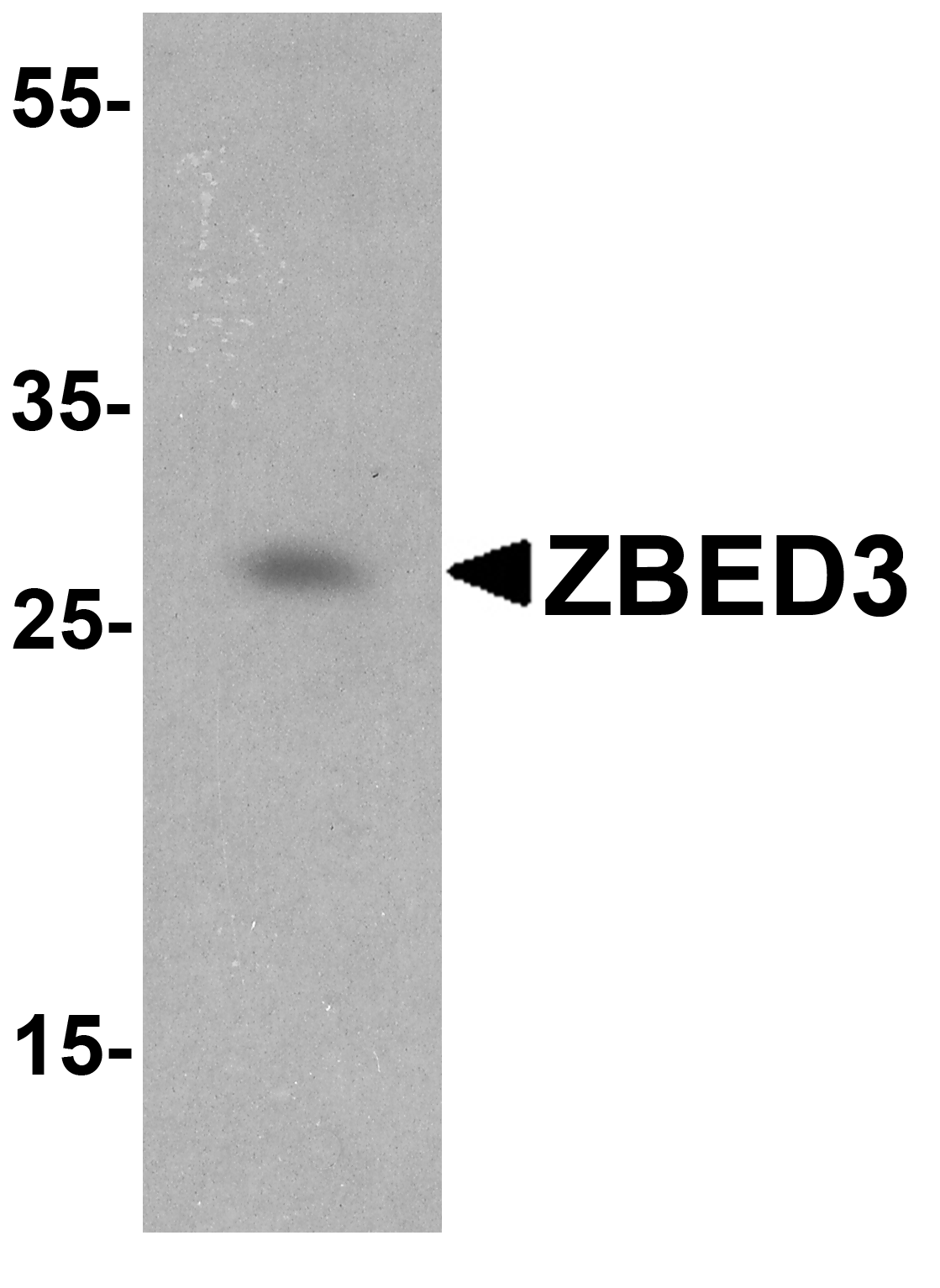 ZBED3 Peptide