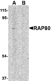 RAP80 Peptide