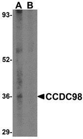 CCDC98 Peptide