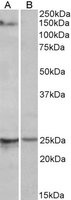 RBM20 Peptide