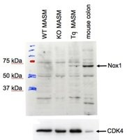 NOX1 Peptide