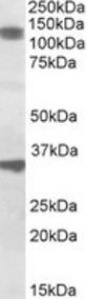 CCAR1 Peptide