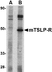 TSLP Receptor Peptide