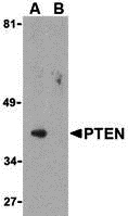 PTEN Peptide
