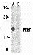 PERP Peptide