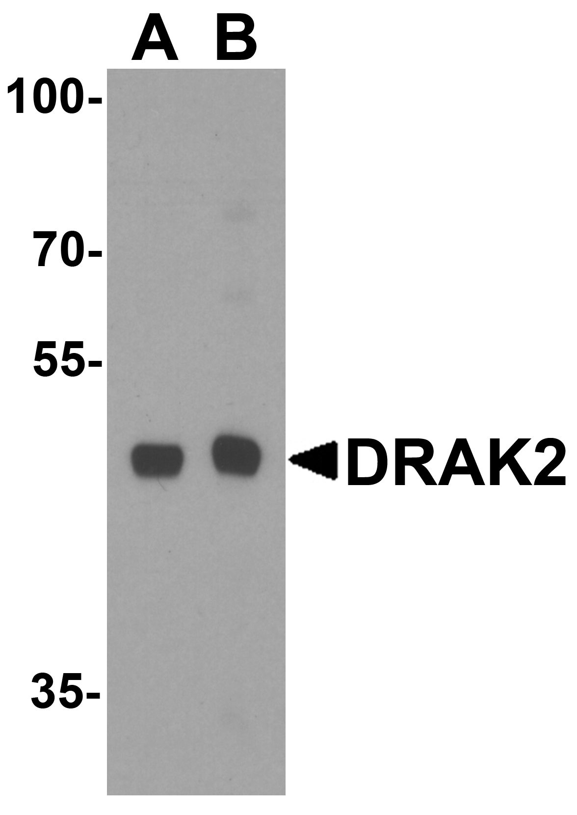 DRAK2 Peptide